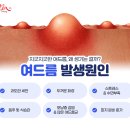피움의원 네이버블로그