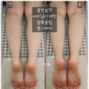 원주 바름뷰티연구소 골반교정 ,종아리 관리 후기