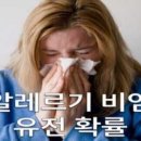 알레르기 비염 유전 및 전염 확률 이미지