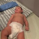 서울석병원 | 아기 엉덩이 딤플 초음파 시기, 비용, 실비청구 - 서울 석병원 이기석원장님 진료 후기