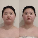 수원-0022 | 영통에스테틱 "아음에스테틱" 작은얼굴윤곽관리 후기 | 단기간 변화가 필요한 분들께 추천