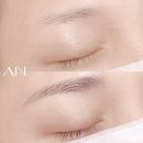 아인 메디칼 이미지