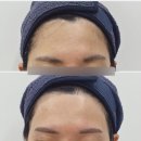 아밍 뷰티 | 남악 피부관리&왁싱 페이스 왁싱 후기 아밍뷰티
