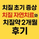 동영빌딩 | 치질초기증상 있던 동영치질 친구 치질자연치료와 치질약 2개월 후기