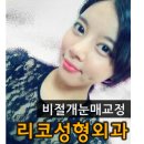 리코성형외과의원 | 쌍꺼풀수술 후기 - 리코성형외과