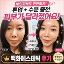 광주 첨단피부관리 예민피부 톤업 수분관리 후기, 백화에스테틱