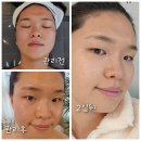 피부 일산피부관리 일산대화동피부관리샵 알엔뷰티랩&amp;스칼프디자인센터 일산에서 피부 광명 찾은 후기