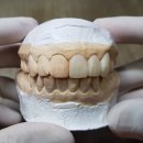 이건치과기공소 이미지