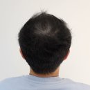 에프앤디별내플레이스 | 남양주모발생장 탈모 고민 에프앤디별내플레이스에서 해답을 찾았어요