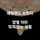 메릴랜드치과 티스토리