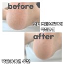 창원각질관리 문제성발관리추천 : 전문적인 닥터아이엔 공감네일 후기