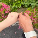광안자모병원 | 자연분만 도전!? 임신40주차 이슬, 양수과소증 진단, 진통 맛보고 제왕엔딩,, 광안자모병원 제왕절개 후기