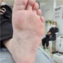 수블리네일 | 부산 동래구 사직동 발각질 제거 대만족 후기 수블리네일