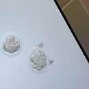 홀드의원 | [난임기록] 창동 난임병원 동결배아 이식 후기 시험관 비용