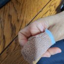 연세스탠다정형외과의원 | 신사역 수부전문병원 <연세스탠다정형외과의원> 손가락 수술 후기