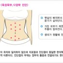 바비퀸