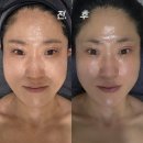 문화아파트 맞은편 구덕운동장 입구 | 대신동윤곽관리 비체봉 비대칭 교정전문 비체 스킨앤바디랩