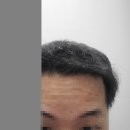 미소 한약국 | 미소산 복용 1년 후기