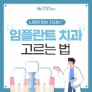 [안산예치과] 안산치과 임플란트 전과 후에 관리 잘 하려면 이미지