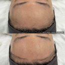 미원장 | 대전 스킨플래닝 웨딩관리 후기 좋은 곳 뷰마르 판암점