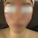 나임 | 인천서구웨딩관리 나임피부연구소 예신 승모근, 데콜테 관리 후기