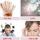 복시 현상 뜻 원인 한 번에 정리 이미지