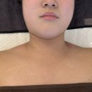 GS25 포항양덕법원점 | 빛결 에스테틱 장성동 윤곽관리 승모 관리 잘하는 집, 웨딩관리로도 추천