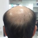화성미용실김호증모가발 이미지
