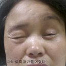 면역력 약하고환절기 구안아사 치료잘하는 전주송천동 해나무 한의원 일요진료 추나치료 이미지