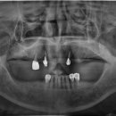심플인플란트치과의원 이미지