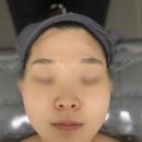 상동약국 | 부천피부관리 더예쁠예정 부천상동역점 작은얼굴관리 후기