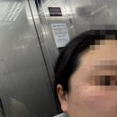 신촌카리스빌딩 | 서울 신촌 유온느 의원 - 편평사마귀 100개 제거 가격 공유, 일주일 된 후기