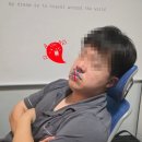 팩코 | 닥터클린코 천궁숨숨팩 비강찜질팩 코찜질팩 사용 후기