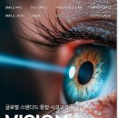 비전(Vision- | 스마일프로후기 확인만큼 중요한 비전가이드 검사 기준