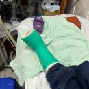 세븐일레븐 광주희망병원점 | [내돈내산] 광주 희망병원 정형외과 아들 발등 골절 치료 후기 (feat. 송근상 원장님)