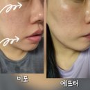구디스터 네이버블로그