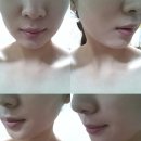 오렌지한의원 네이버블로그