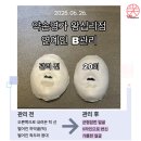 K.B샵 | 턱선이 이렇게 달라졌어요? K뷰티연예인B 리얼 후기 [석고본 비교]