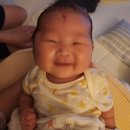 (주)더아이엠씨 | 신생아 아기 혈관종 전주 키즈드림 치료 후기_1