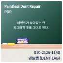 덴트핀다 이미지
