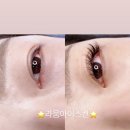 라움아이스킨
