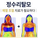 정희헤어라인 | 열 오를때 어떻게 해야해요? 탈모되는거 아닌가요? / 해운대미용실 센트헤어 해운대동백점 정희지원장