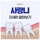 힘찬플란트치과의원 | 호평동치과 내 사랑니는 어떤 모양일까? 유형별 사랑니발치 방법과 난이도