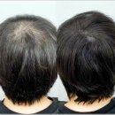 그레이시티 광주직영점 | 광주두피관리 받고 느낀 점 그레이시티 광주직영점 솔직 후기