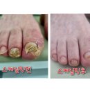 라룸네일