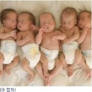 쌍둥이 이미지