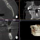 수정기공사 이미지