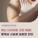 슬림한 바디 | 예신 다이어트 고민 해결! 결혼식 전 팔뚝살 시술로 슬림한 바디라인 만들기