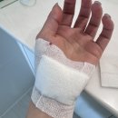 드림마취통증의학과의원 | 대구 힘드림마취통증의학과의원 손 찢어짐 손 열상 치료 과정 및 회복 기간 총정리