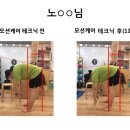 모션케어 이미지
